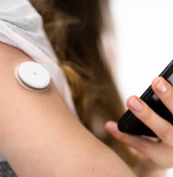 Prefeitura de Pouso Alegre amplia cuidado com pacientes diabéticos e passa a oferecer sensor de monitoramento contínuo de glicose
